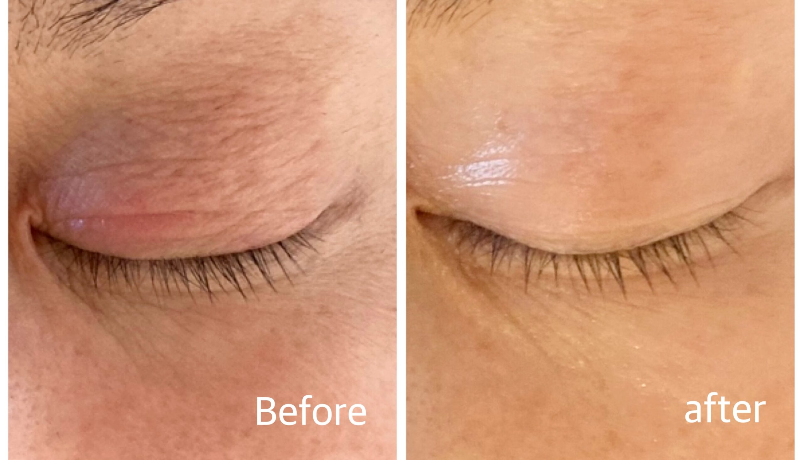 トラブル肌修復トリートメント施術イメージ